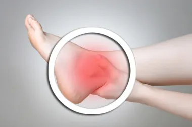 Cómo tratar naturalmente el esguince de tobillo