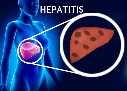 Cómo prevenir la hepatitis B