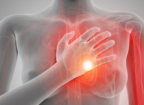 Herzinfarkt - Schaubild mit Hand auf der Brust