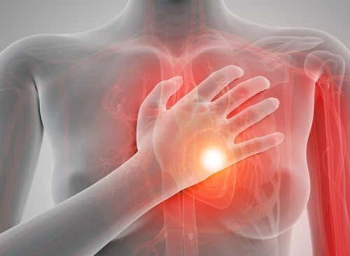 Herzinfarkt - Schaubild mit Hand auf der Brust
