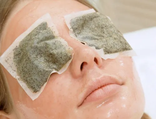 Las ojeras, qué son, las causas, tipos y remedios