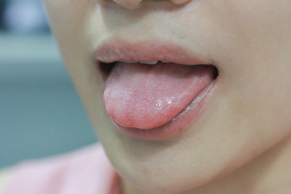 ¿Te levantas por las mañanas con un sabor amargo en la boca? — Mejor