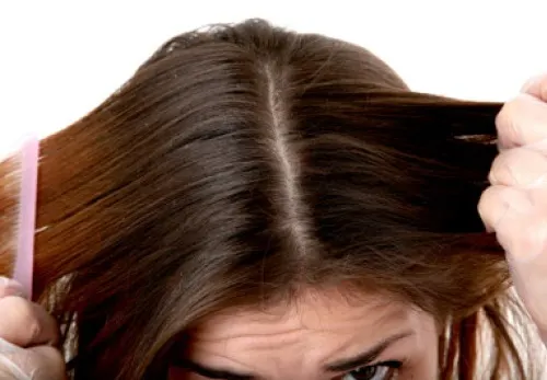 Tratamiento para el cabello graso