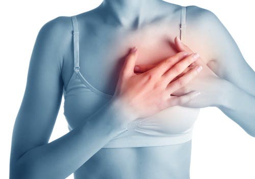 Cuidados necesarios después de un infarto