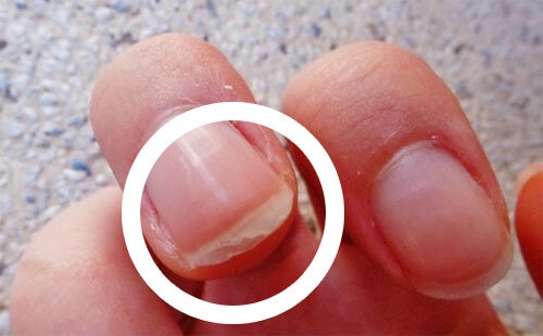 La mejor manera para endurecer las uñas - Mejor Salud %