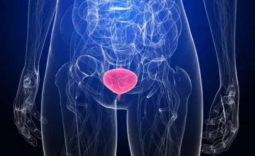 Mujer con cistitis.