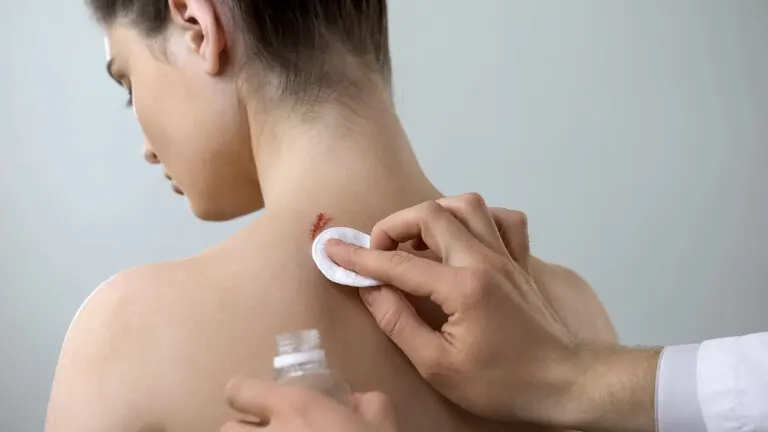 ¿Cómo curar una herida para que no deje cicatriz?