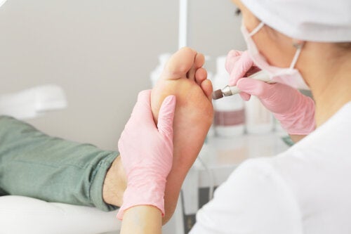 Cómo eliminar las callosidades en los pies