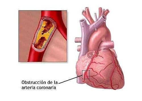 8 hábitos cotidianos que pueden causarnos problemas cardiacos