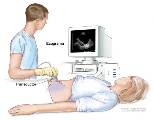 Procedimiento de ecografía abdominal