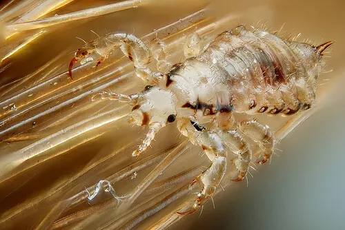 Cómo eliminar piojos y liendres de manera natural