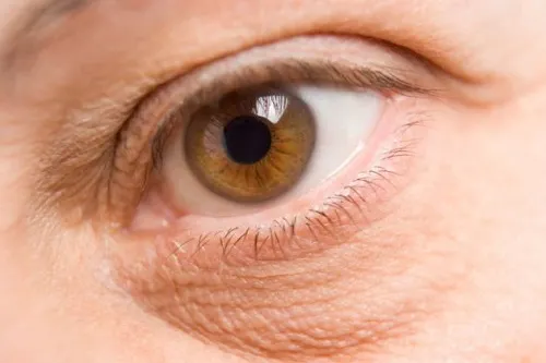 ¿Cómo aclarar o eliminar las ojeras?