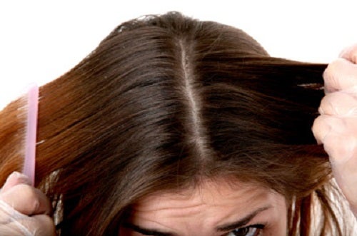 textura Duplicar prometedor Qué hacer para tratar el cabello graso? - Mejor con Salud