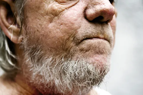 Coloracion-de-las-canas