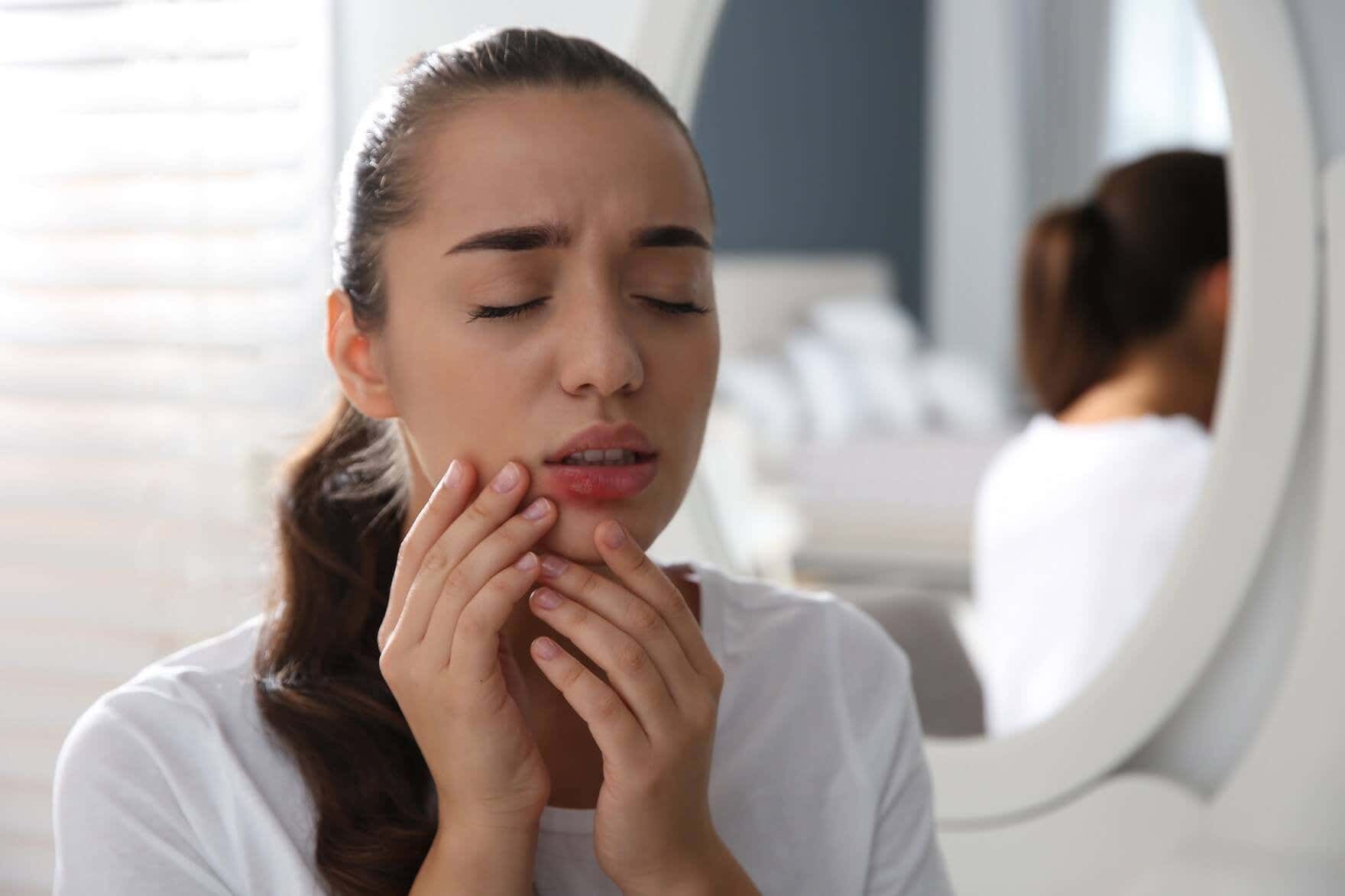 17 tratamientos naturales contra el herpes labial