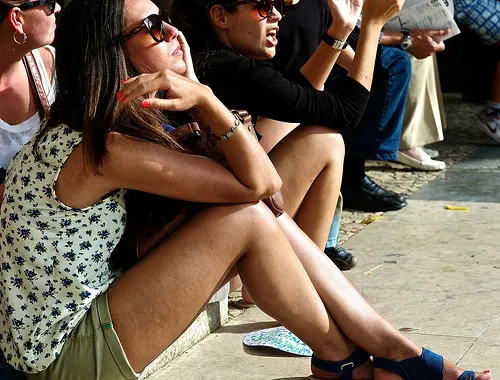 varicose veins in the summer