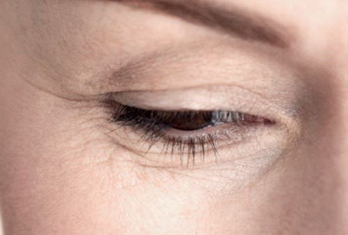Cómo quitar las arrugas bajo los ojos