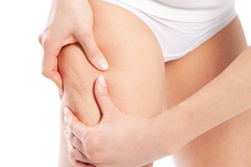 Plantas medicinales para luchar contra la celulitis
