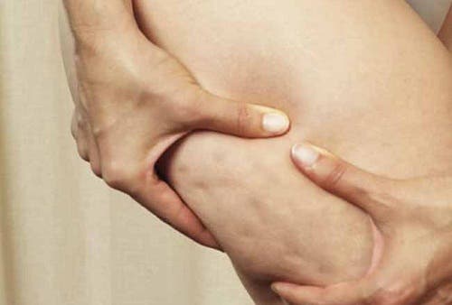 Aceite de coco, limón y pomelo, remedio natural contra la celulitis