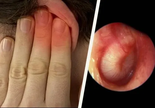 Collage Dolor Oidos