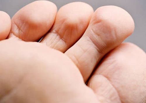 Tratamiento y prevención del mal olor en los pies