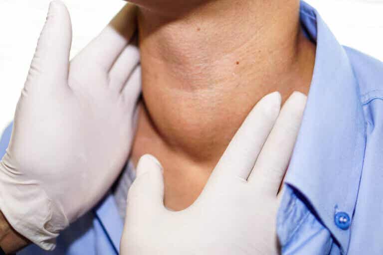 El bocio: la inflamación de la glándula tiroidea