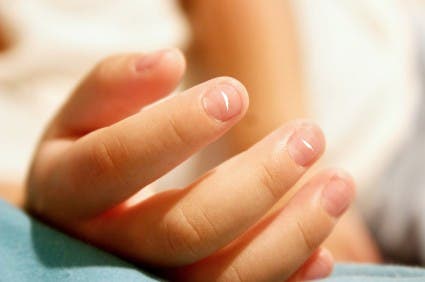 Manchas en las uñas
