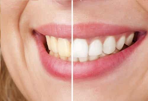 5 ideas naturales para blanquear los dientes