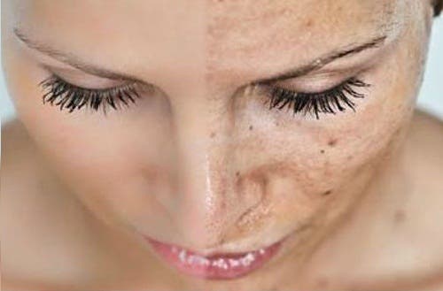 4 causas del envejecimiento prematuro