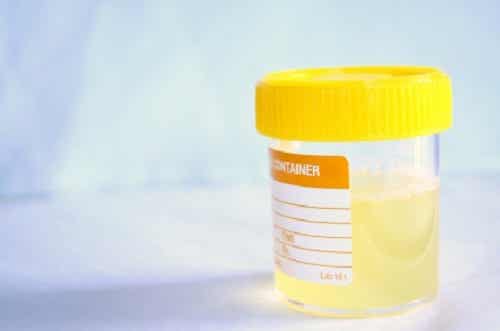 16 remedios caseros para la infección urinaria