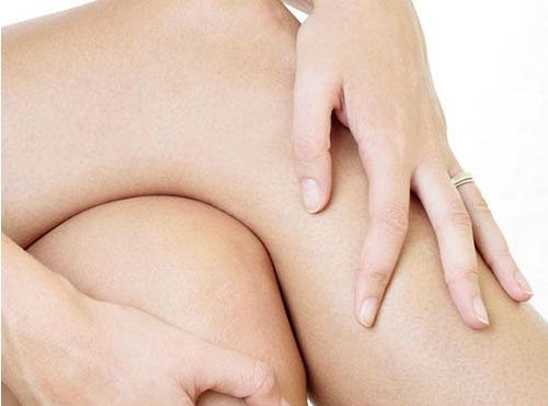 Tips para lucir rodillas perfectas