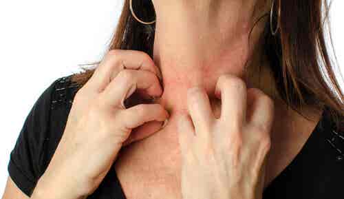 Mujer rascándose el cuello por sarpullido en la piel.