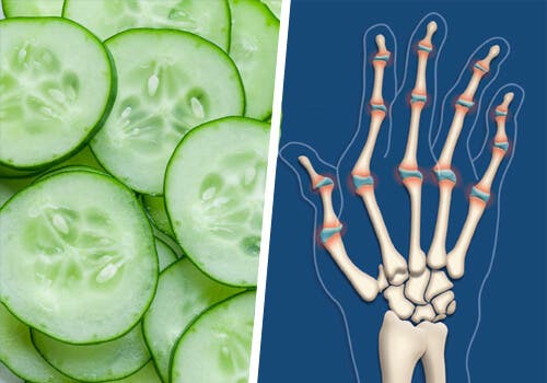 Artritis reumatoide: claves para la alimentación