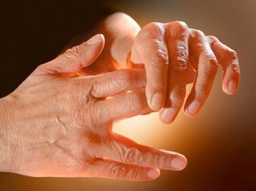 Causas del hormigueo en manos y piernas