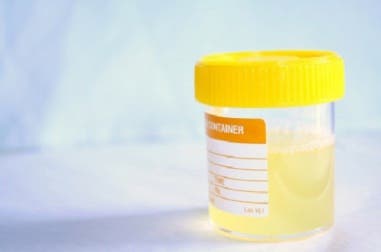 Cómo prevenir naturalmente las infecciones urinarias