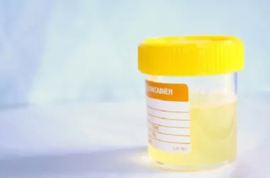 Cómo prevenir naturalmente las infecciones urinarias