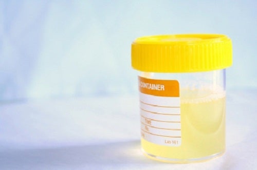 Cómo prevenir naturalmente las infecciones urinarias