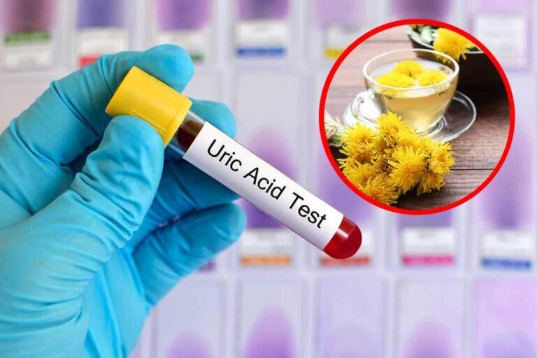 Hierbas medicinales para aliviar el ácido úrico