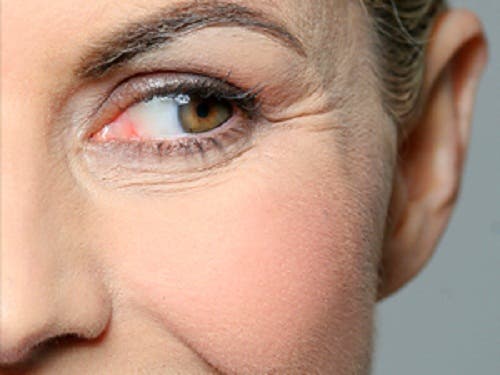 6 Tips para prevenir las arrugas prematuras