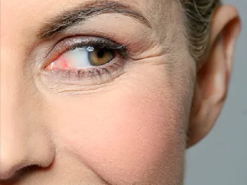 6 Tips para prevenir las arrugas prematuras