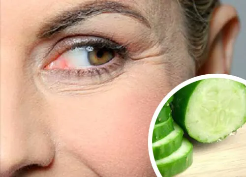 Disimula las arrugas con estos remedios naturales