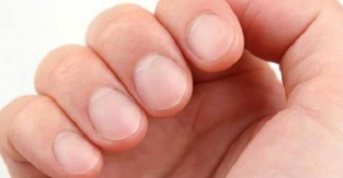8 señales de advertencia de salud que tus uñas podrían estar revelando