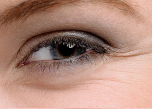 4 cremas caseras para el contorno de los ojos