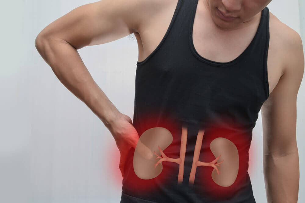 Hombre con dolor en los riñones: esclerosis renal.