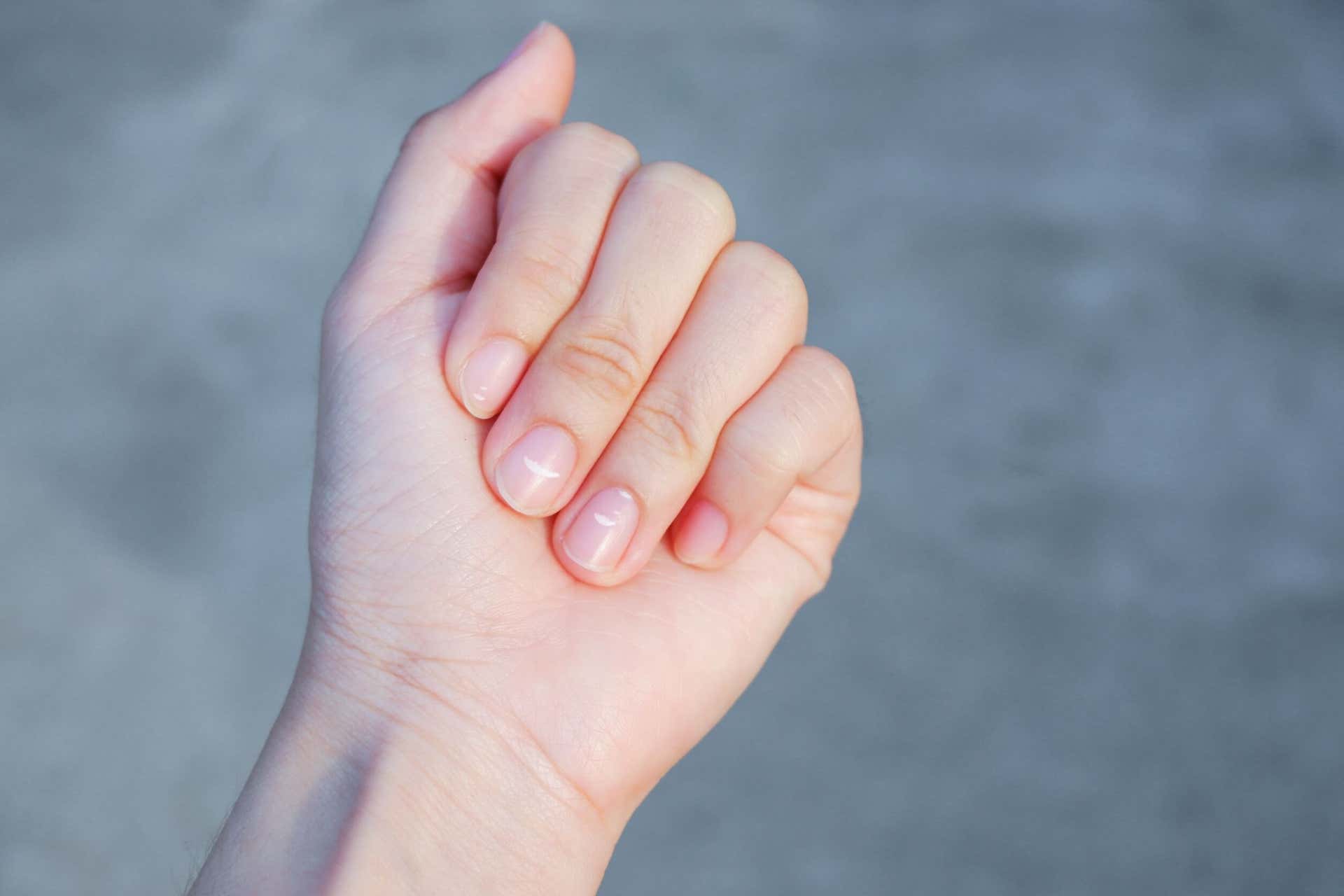 Las señales de advertencia de salud que tus uñas son evidentes