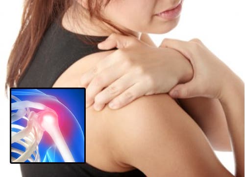 Mujer con dolor en los hombros.