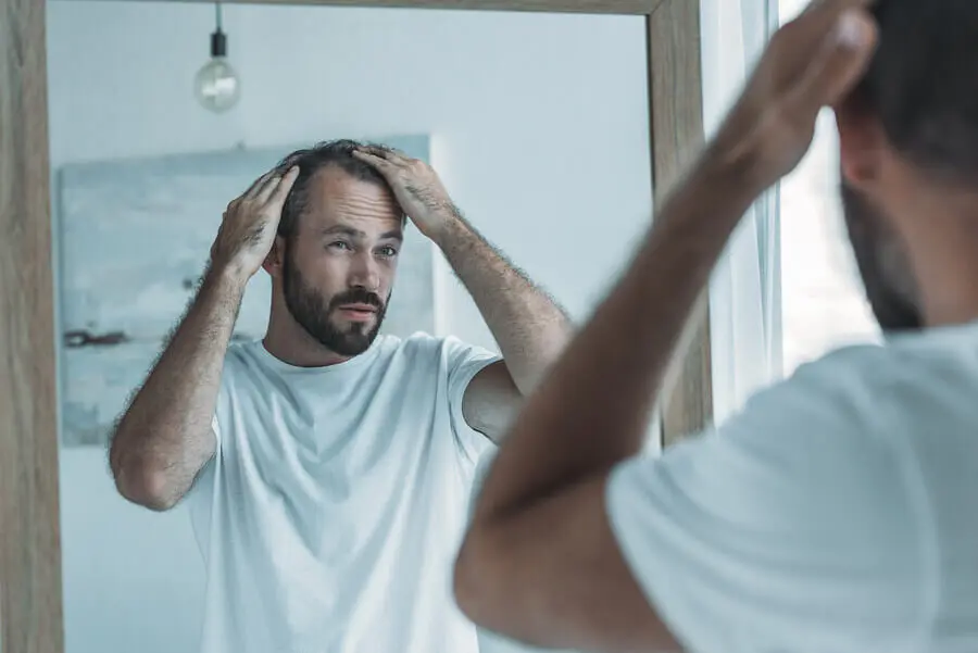 Hombre con alopecia