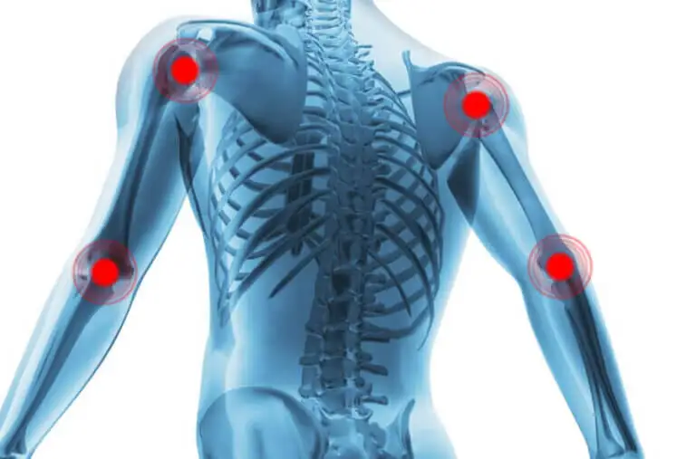 10 Remedios caseros para la artritis y el dolor articular