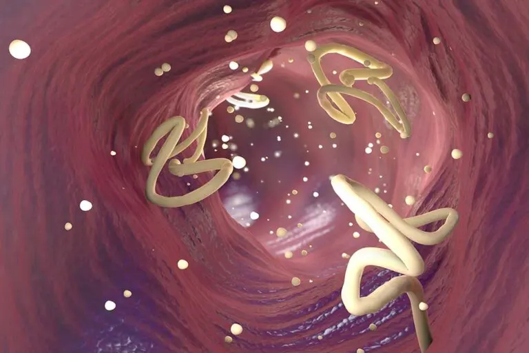 Elimina los parásitos intestinales con ajo y semillas de calabaza