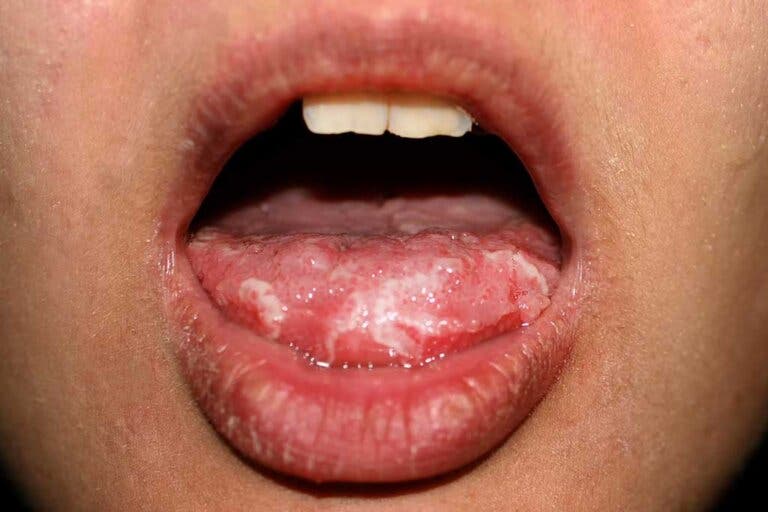 La lengua puede revelar tu estado emocional y tu salud